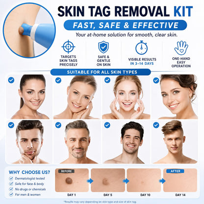 Auraex Gentle Skin Tag & Wart Remover